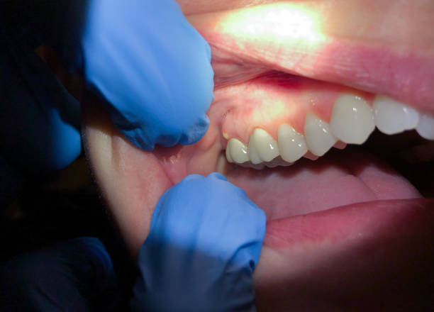 Best Broken Tooth Emergency  in Greer, SC