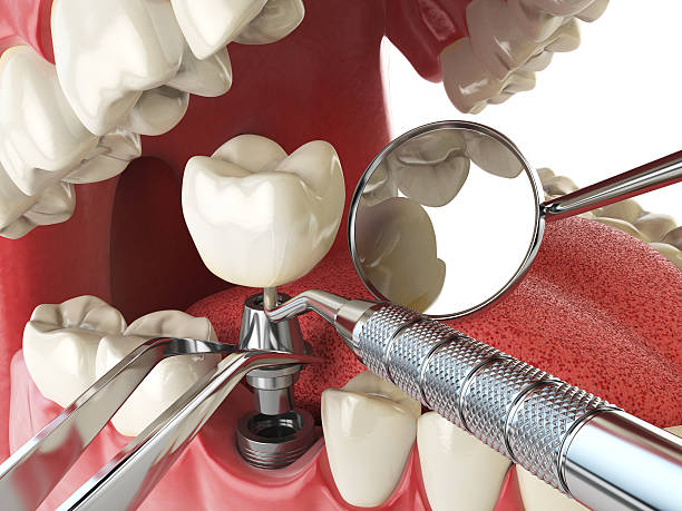 Emergency Dentist Open Today in SC